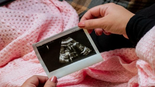 ولاية فلوريدا الأميركية تحظر الإجهاض بعد 15 أسبوعا من الحمل
